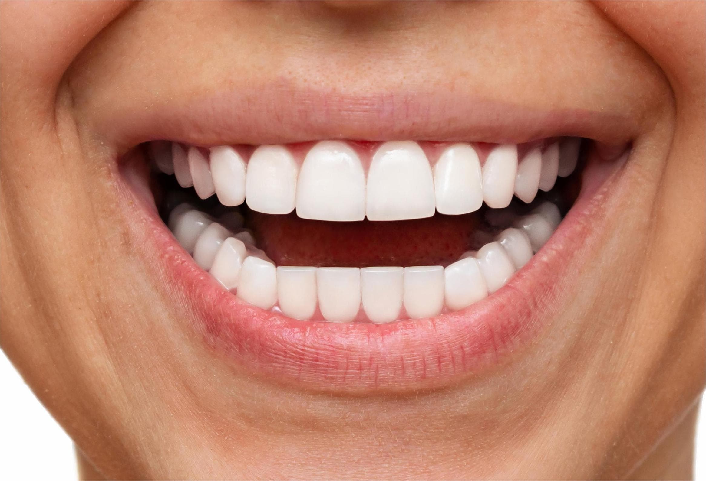 After dental care at City South Dental