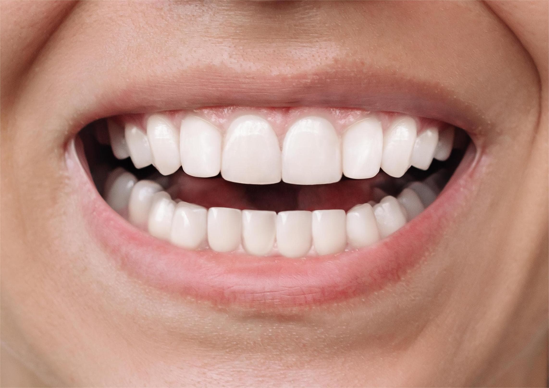 After dental care at City South Dental