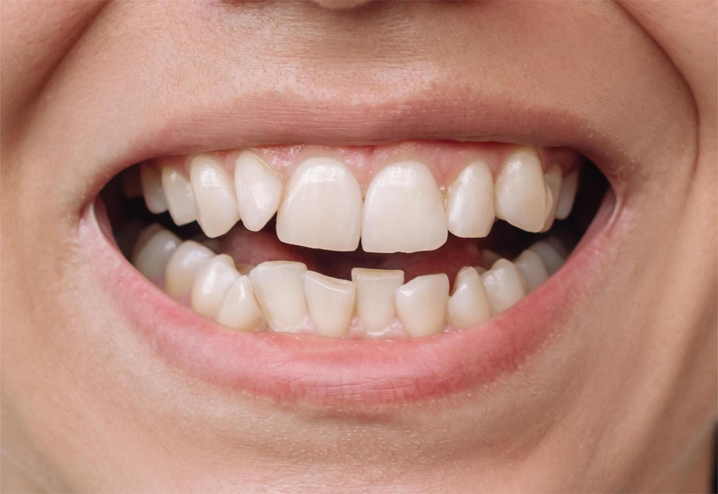 Before dental care at City South Dental